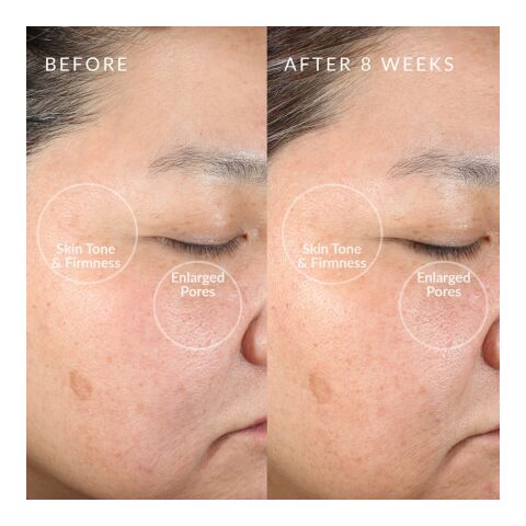 PMD Beauty Clean Face Cleansing Brush Black | No Imprint | not available | not available